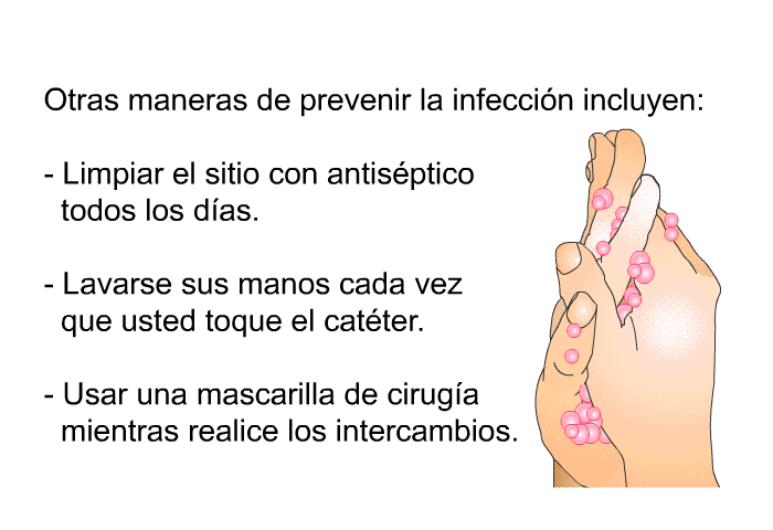 Otras maneras de prevenir la infecci�n incluyen:  Limpiar el sitio con antis�ptico todos los d��as. Lavarse sus manos cada vez que usted toque el cat�ter. Usar una mascarilla de cirug��a mientras realice los intercambios.