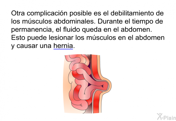 Otra complicaci�n posible es el debilitamiento de los m�sculos abdominales. Durante el tiempo de permanencia, el fluido queda en el abdomen. Esto puede lesionar los m�sculos en el abdomen y causar una hernia.