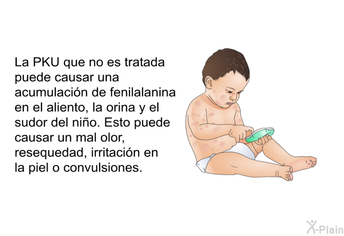 La PKU que no es tratada puede causar una acumulacin de fenilalanina en el aliento, la orina y el sudor del nio. Esto puede causar un mal olor, resequedad, irritacin en la piel o convulsiones.