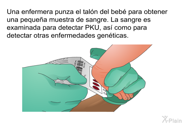 Una enfermera punza el taln del beb para obtener una pequea muestra de sangre. La sangre es examinada para detectar PKU, as como para detectar otras enfermedades genticas.