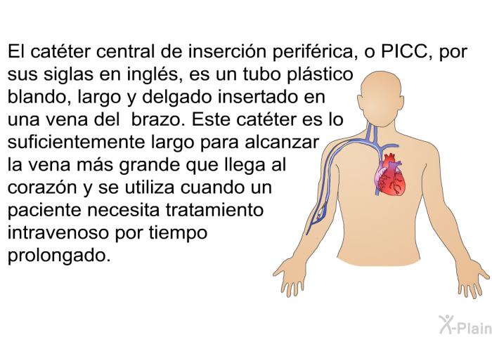 El catter central de insercin perifrica, o PICC, por sus siglas en ingls, es un tubo plstico blando, largo y delgado insertado en una vena del brazo. Este catter es lo suficientemente largo para alcanzar la vena ms grande que llega al corazn y se utiliza cuando un paciente necesita tratamiento intravenoso por tiempo prolongado.