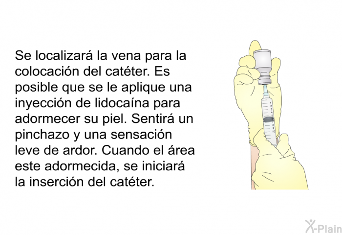 Se localizar la vena para la colocacin del catter. Es posible que se le aplique una inyeccin de lidocana para adormecer su piel. Sentir un pinchazo y una sensacin leve de ardor. Cuando el rea este adormecida, se iniciar la insercin del catter.