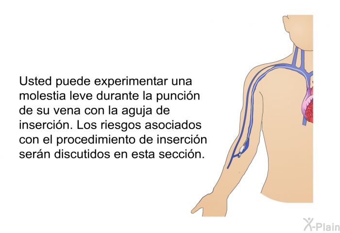 Usted puede experimentar una molestia leve durante la punci�n de su vena con la aguja de inserci�n. Los riesgos asociados con el procedimiento de inserci�n ser�n discutidos en esta secci�n.