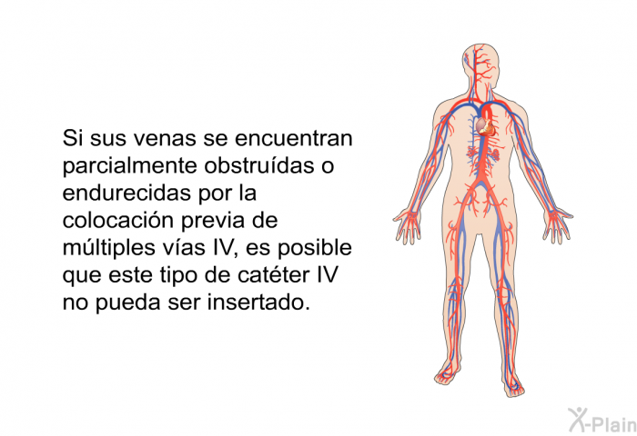 Si sus venas se encuentran parcialmente obstru�das o endurecidas por la colocaci�n previa de m�ltiples v�as IV, es posible que este tipo de cat�ter IV no pueda ser insertado.
