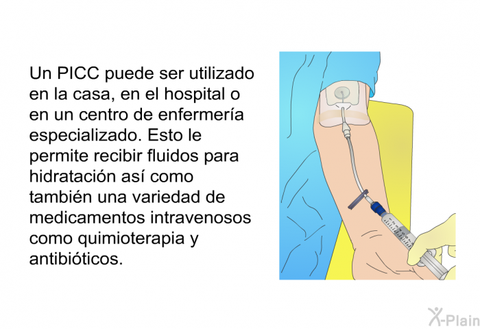 Un PICC puede ser utilizado en la casa, en el hospital o en un centro de enfermera especializado. Esto le permite recibir fluidos para hidratacin as como tambin una variedad de medicamentos intravenosos como quimioterapia y antibiticos.