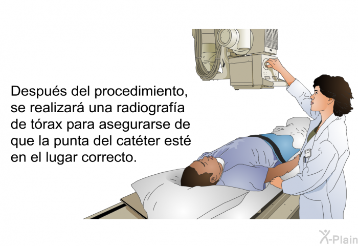 Despus del procedimiento, se realizar una radiografa de trax para asegurarse de que la punta del catter est en el lugar correcto.