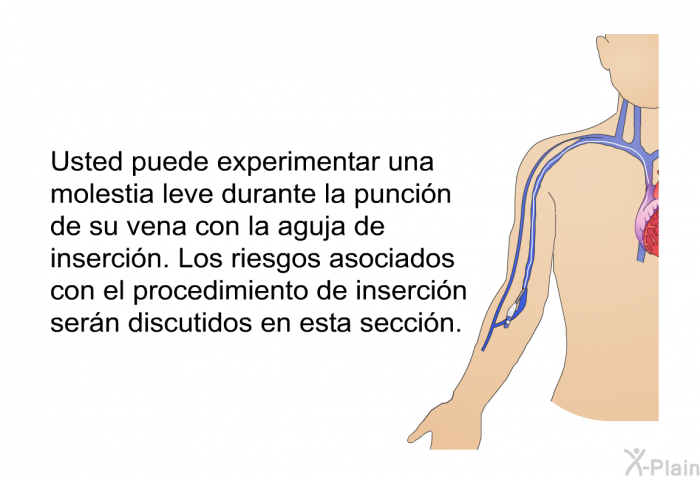 Usted puede experimentar una molestia leve durante la punci�n de su vena con la aguja de inserci�n. Los riesgos asociados con el procedimiento de inserci�n ser�n discutidos en esta secci�n.