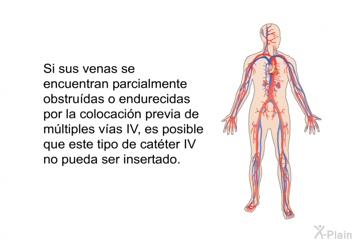 Si sus venas se encuentran parcialmente obstru�das o endurecidas por la colocaci�n previa de m�ltiples v�as IV, es posible que este tipo de cat�ter IV no pueda ser insertado.