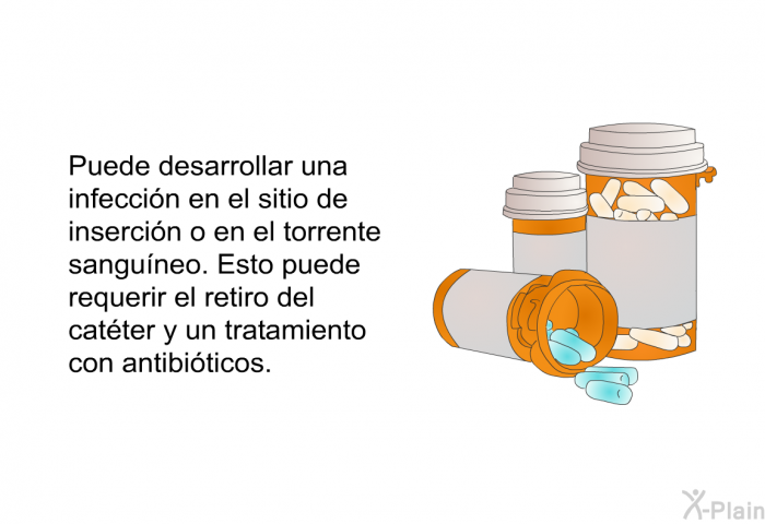 Puede desarrollar una infeccin en el sitio de insercin o en el torrente sanguneo. Esto puede requerir el retiro del catter y un tratamiento con antibiticos.