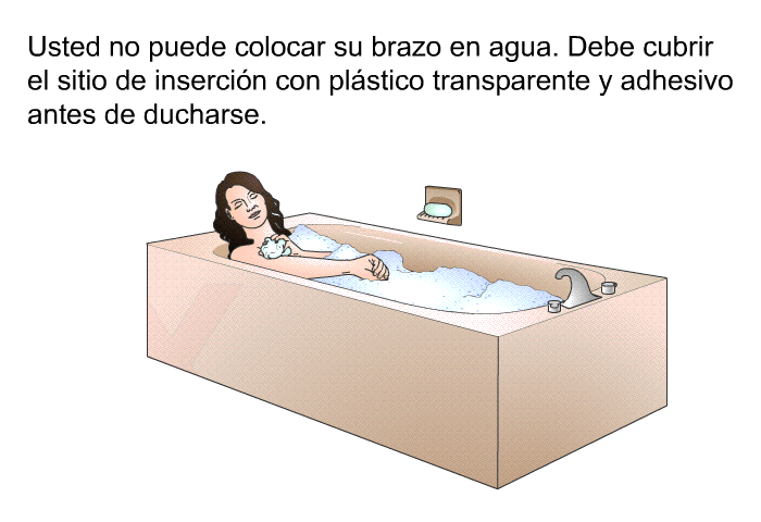 Usted no puede colocar su brazo en agua. Debe cubrir el sitio de insercin con plstico transparente y adhesivo antes de ducharse.