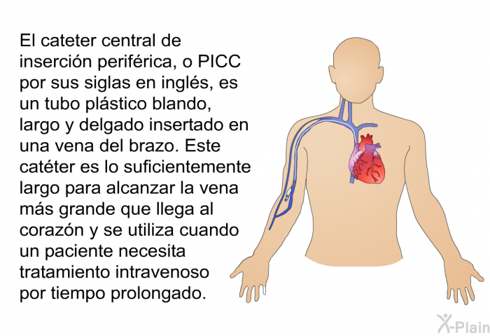El cateter central de insercin perifrica, o PICC por sus siglas en ingls, es un tubo plstico blando, largo y delgado insertado en una vena del brazo. Este catter es lo suficientemente largo para alcanzar la vena ms grande que llega al corazn y se utiliza cuando un paciente necesita tratamiento intravenoso por tiempo prolongado.
