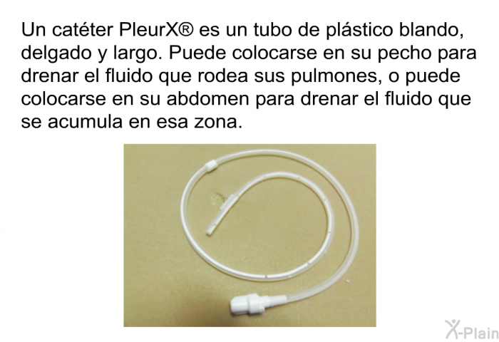 Un catter PleurX<SUP> </SUP> es un tubo de plstico blando, delgado y largo. Puede colocarse en su pecho para drenar el fluido que rodea sus pulmones, o puede colocarse en su abdomen para drenar el fluido que se acumula en esa zona.