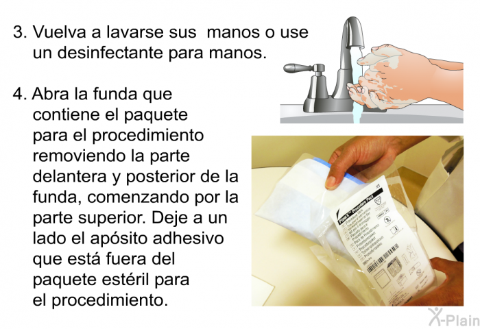 Vuelva a lavarse sus manos o use un desinfectante para manos. Abra la funda que contiene el paquete para el procedimiento removiendo la parte delantera y posterior de la funda, comenzando por la parte superior. Deje a un lado el apsito adhesivo que est fuera del paquete estril para el procedimiento.