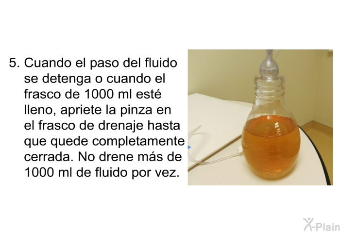 Cuando el paso del fluido se detenga o cuando el frasco de 1000 ml est� lleno, apriete la pinza en el frasco de drenaje hasta que quede completamente cerrada. No drene m�s de 1000 ml de fluido por vez.