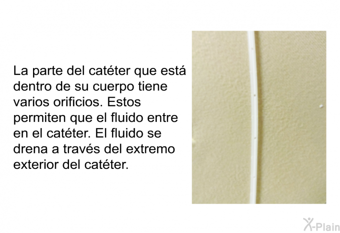 La parte del catter que est dentro de su cuerpo tiene varios orificios. Estos permiten que el fluido entre en el catter. El fluido se drena a travs del extremo exterior del catter.