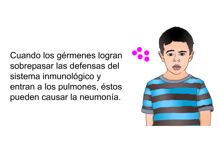 Cuando los grmenes logran sobrepasar las defensas del sistema inmunolgico y entran a los pulmones, stos pueden causar la neumona.