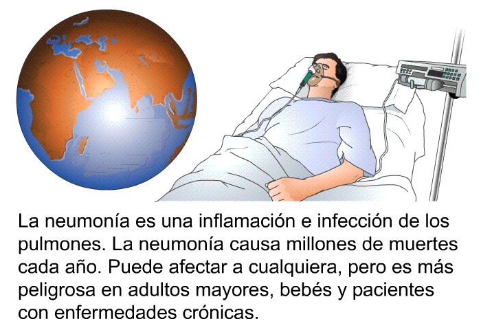 La neumona es una inflamacin e infeccin de los pulmones. La neumona causa millones de muertes cada ao. Puede afectar a cualquiera, pero es ms peligrosa en adultos mayores, bebs y pacientes con enfermedades crnicas.