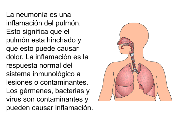 La neumona es una inflamacin del pulmn. Esto significa que el pulmn esta hinchado y que esto puede causar dolor. La inflamacin es la respuesta normal del sistema inmunolgico a lesiones o contaminantes. Los grmenes, bacterias y virus son contaminantes y pueden causar inflamacin.