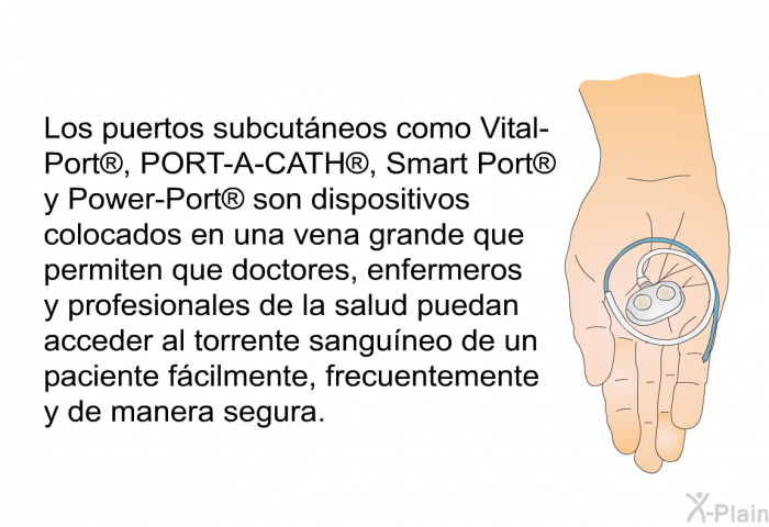 Los puertos subcutneos como Vital-Port , PORT-A-CATH , Smart Port  y Power-Port  son dispositivos colocados en una vena grande que permiten que doctores, enfermeros y profesionales de la salud puedan acceder al torrente sanguneo de un paciente fcilmente, frecuentemente y de manera segura.