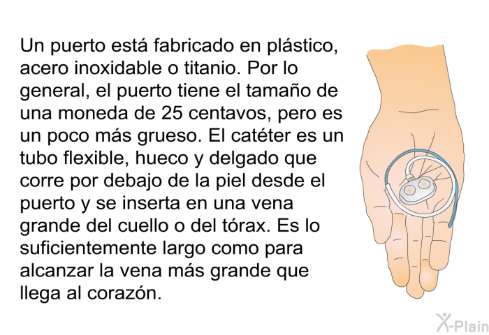 Un puerto est fabricado en plstico, acero inoxidable o titanio. Por lo general, el puerto tiene el tamao de una moneda de 25 centavos, pero es un poco ms grueso. El catter es un tubo flexible, hueco y delgado que corre por debajo de la piel desde el puerto y se inserta en una vena grande del cuello o del trax. Es lo suficientemente largo como para alcanzar la vena ms grande que llega al corazn.