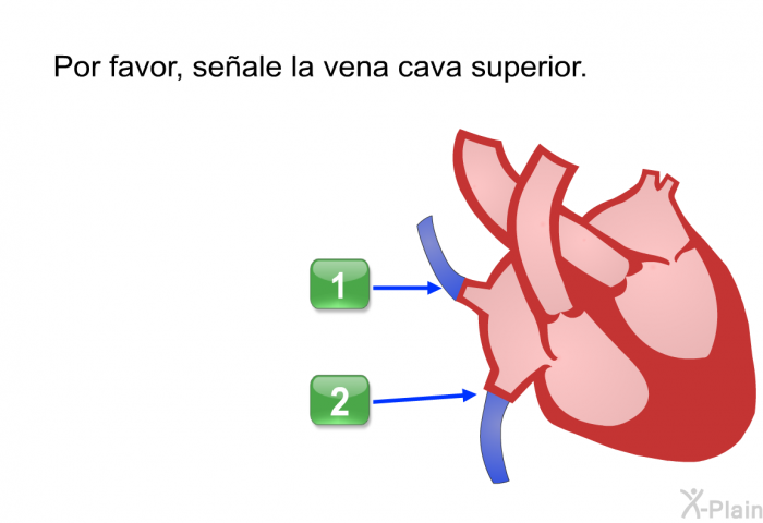 Por favor, seale la vena cava superior.