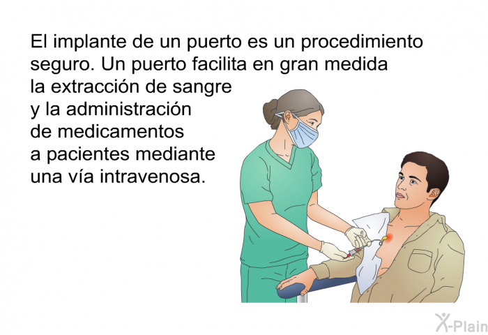 El implante de un puerto es un procedimiento seguro. Un puerto facilita en gran medida la extraccin de sangre y la administracin de medicamentos a pacientes mediante una va intravenosa.