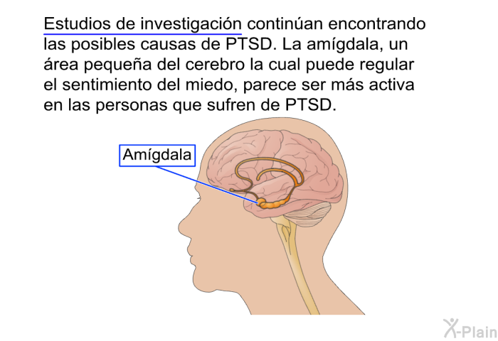 Estudios de investigacin continan encontrando las posibles causas de PTSD. La amgdala, un rea pequea del cerebro la cual puede regular el sentimiento del miedo, parece ser ms activa en las personas que sufren de PTSD.<U> </U>