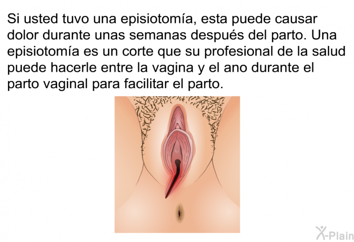 Si usted tuvo una episiotoma, esta puede causar dolor durante unas semanas despus del parto. Una episiotoma es un corte que su profesional de la salud puede hacerle entre la vagina y el ano durante el parto vaginal para facilitar el parto.