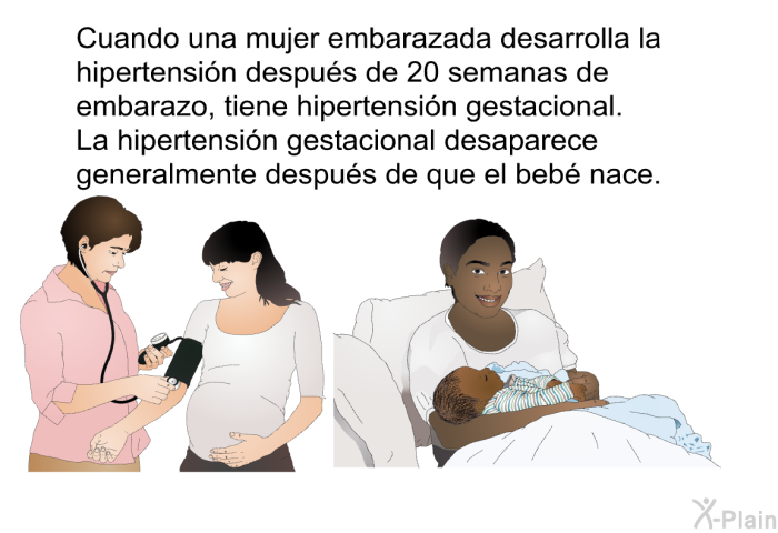 Cuando una mujer embarazada desarrolla la hipertensin despus de 20 semanas de embarazo, tiene hipertensin gestacional. La hipertensin gestacional desaparece generalmente despus de que el beb nace.