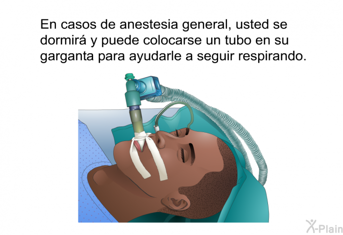 En casos de anestesia general, usted se dormir� y puede colocarse un tubo en su garganta para ayudarle a seguir respirando.