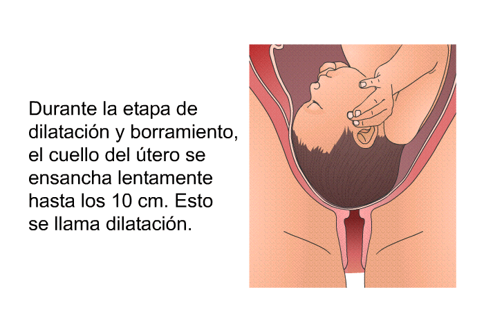 Durante la etapa de dilatacin y borramiento, el cuello del tero se ensancha lentamente hasta los 10 cm. Esto se llama dilatacin.