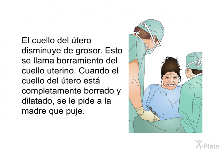 El cuello del tero disminuye de grosor. Esto se llama borramiento del cuello uterino. Cuando el cuello del tero est completamente borrado y dilatado, se le pide a la madre que puje.
