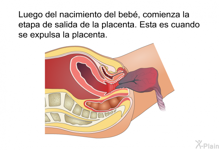 Luego del nacimiento del beb, comienza la etapa de salida de la placenta. Esta es cuando se expulsa la placenta.