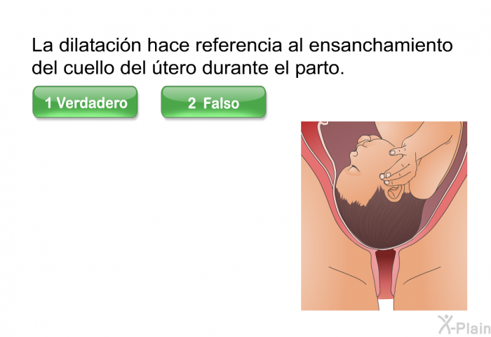 La dilatacin hace referencia al ensanchamiento del cuello del tero durante el parto.