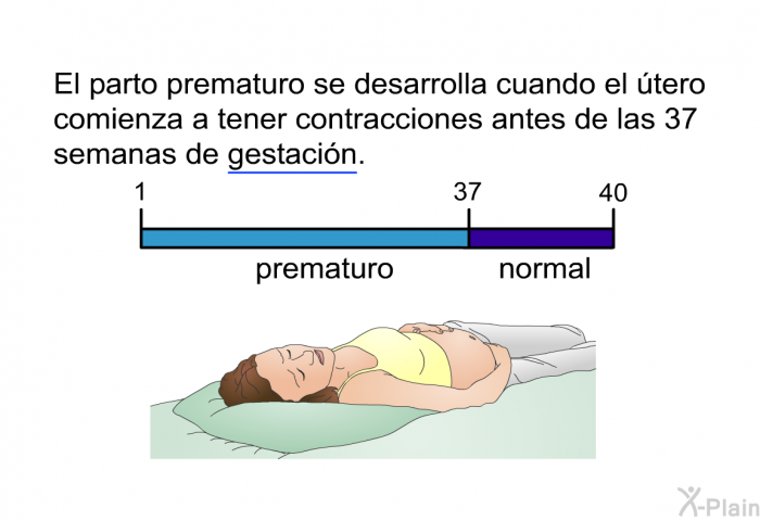 El parto prematuro se desarrolla cuando el tero comienza a tener contracciones antes de las 37 semanas de gestacin.