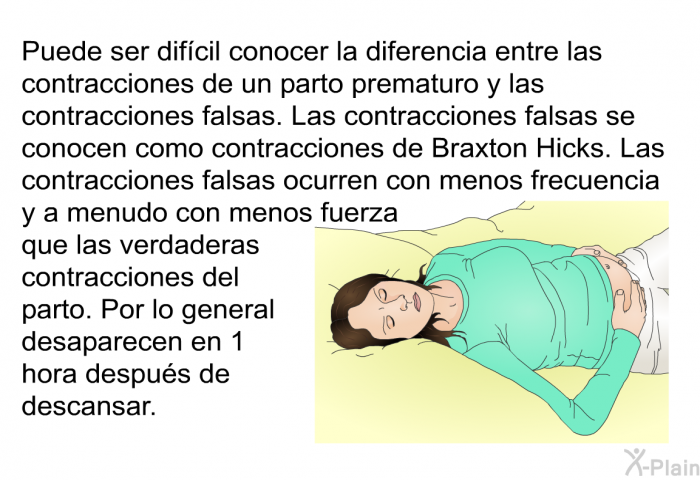 Puede ser difcil conocer la diferencia entre las contracciones de un parto prematuro y las contracciones falsas. Las contracciones falsas se conocen como contracciones de Braxton Hicks. Las contracciones falsas ocurren con menos frecuencia y a menudo con menos fuerza que las verdaderas contracciones del parto. Por lo general desaparecen en 1 hora despus de descansar.