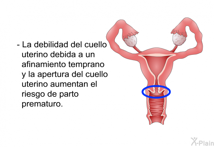 La debilidad del cuello uterino debida a un afinamiento temprano y la apertura del cuello uterino aumentan el riesgo de parto prematuro.