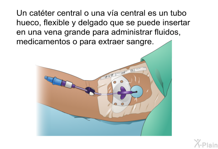 Un catter central o una va central es un tubo hueco, flexible y delgado que se puede insertar en una vena grande para administrar fluidos, medicamentos o para extraer sangre.