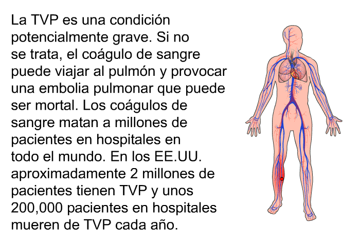 La TVP es una condicin potencialmente grave. Si no se trata, el cogulo de sangre puede viajar al pulmn y provocar una embolia pulmonar que puede ser mortal. Los cogulos de sangre matan a millones de pacientes en hospitales en todo el mundo. En los EE.UU. aproximadamente 2 millones de pacientes tienen TVP y unos 200,000 pacientes en hospitales mueren de TVP cada ao.
