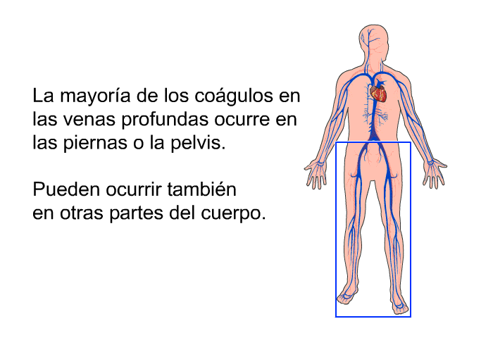 La mayora de los cogulos en las venas profundas ocurre en las piernas o la pelvis. Pueden ocurrir tambin en otras partes del cuerpo.