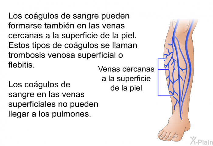 Los cogulos de sangre pueden formarse tambin en las venas cercanas a la superficie de la piel. Estos tipos de cogulos se llaman trombosis venosa superficial o flebitis. Los cogulos de sangre en las venas superficiales no pueden llegar a los pulmones.