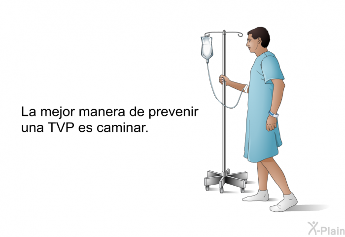 La mejor manera de prevenir una TVP es caminar.