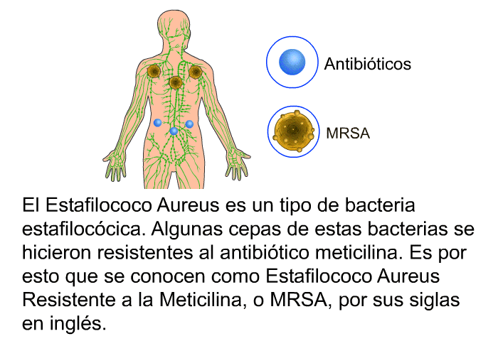 El Estafilococo Aureus es un tipo de bacteria estafiloccica. Algunas cepas de estas bacterias se hicieron resistentes al antibitico meticilina. Es por esto que se conocen como Estafilococo Aureus Resistente a la Meticilina, o MRSA, por sus siglas en ingls.