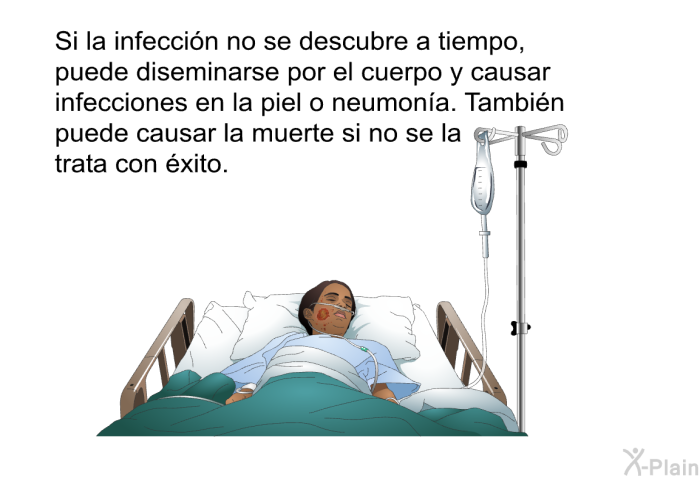 <B>Usted puede ser un portador.</B>
 Si es un portador, usted no tiene sntomas visibles, pero tiene MRSA en la piel y dentro de la nariz. De ser un portador, su mdico puede decirle que usted est 