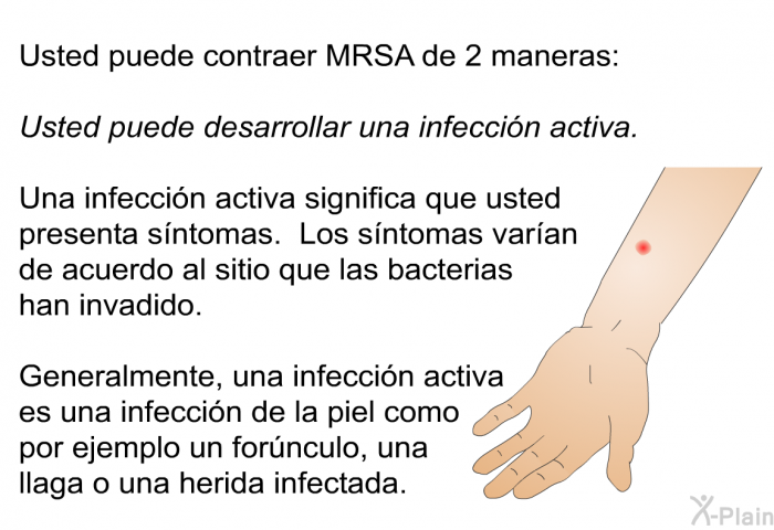 Usted puede contraer MRSA de 2 maneras:
Usted puede desarrollar una infeccin activa. Una infeccin activa significa que usted presenta sntomas. Los sntomas varan de acuerdo al sitio que las bacterias han invadido.
Generalmente, una infeccin activa es una infeccin de la piel como por ejemplo un fornculo, una llaga o una herida infectada.