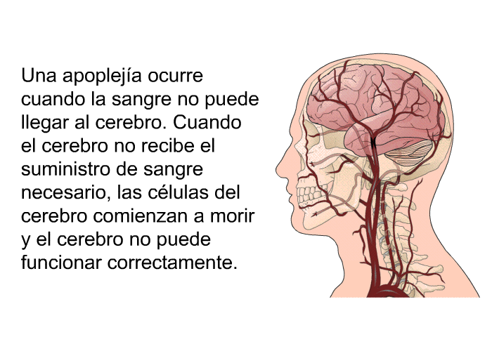 Una apopleja ocurre cuando la sangre no puede llegar al cerebro. Cuando el cerebro no recibe el suministro de sangre necesario, las clulas del cerebro comienzan a morir y el cerebro no puede funcionar correctamente.