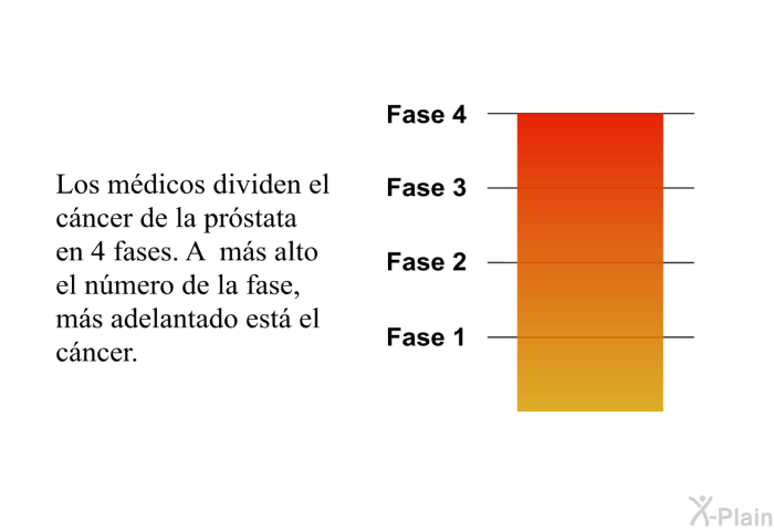 Los m�dicos dividen el c�ncer de la pr�stata en 4 fases. A m�s alto el n�mero de la fase, m�s adelantado est� el c�ncer.
