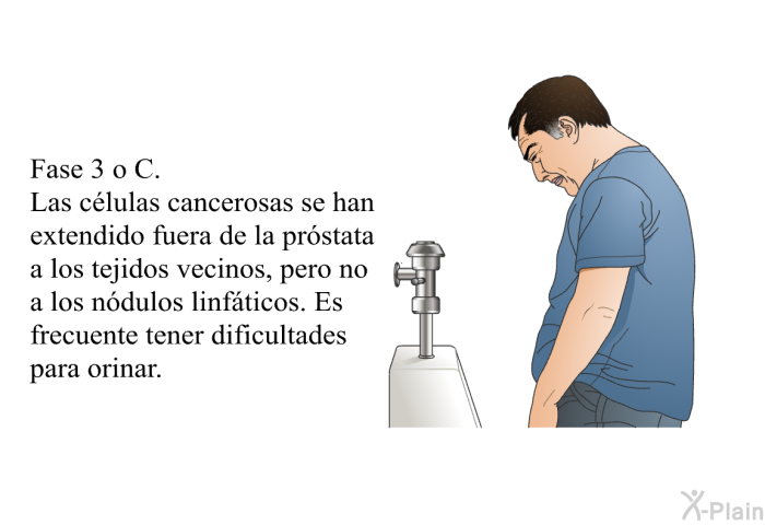Fase 3 o C. Las c�lulas cancerosas se han extendido fuera de la pr�stata a los tejidos vecinos, pero no a los n�dulos linf�ticos. Es frecuente tener dificultades para orinar.