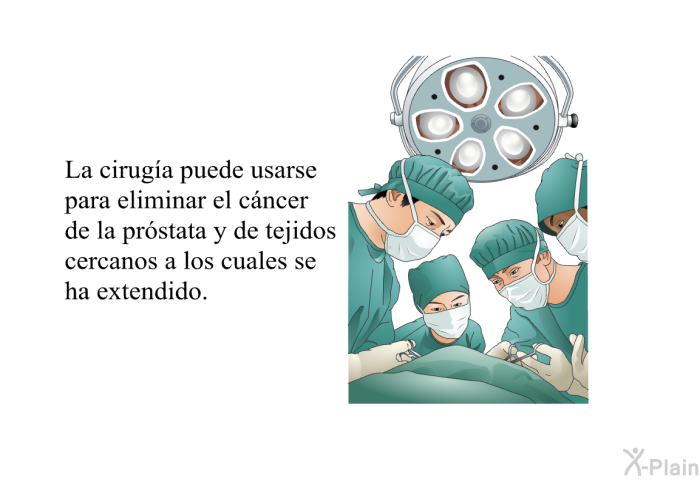 La cirug�a puede usarse para eliminar el c�ncer de la pr�stata y de tejidos cercanos a los cuales se ha extendido.