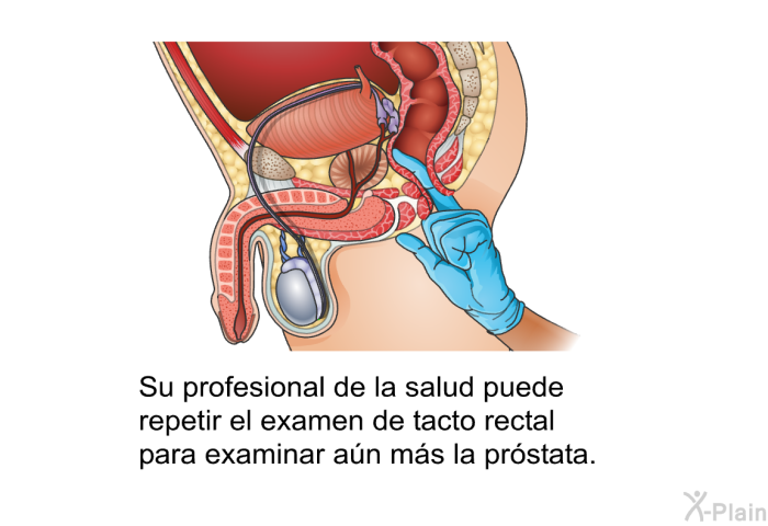 Su profesional de la salud puede repetir el examen de tacto rectal para examinar a�n m�s la pr�stata.